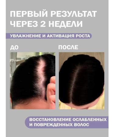 Korney Hair growth serum - Buy Online on GoSupps.com