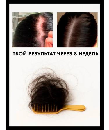 Korney Hair growth serum - Buy Online on GoSupps.com