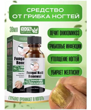 Chinese remedy for nail fungus 30 ml