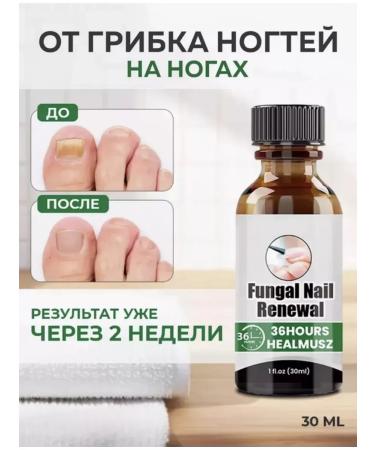 Chinese remedy for nail fungus 30 ml - Buy Online on GoSupps.com