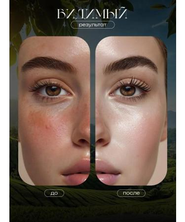 Totti Beauty Gel-gap for face with mucin snail - Buy Online on GoSupps.com