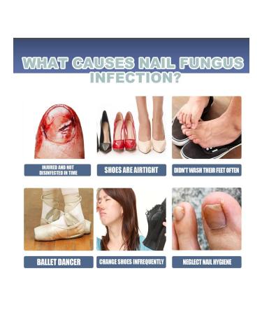 Ximonth antifungal set for nail care - Buy Online on GoSupps.com