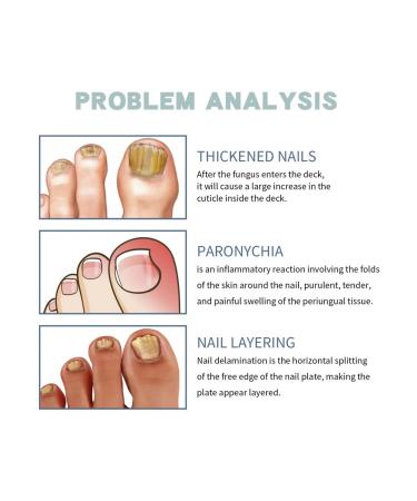 Ximonth antifungal set for nail care - Buy Online on GoSupps.com