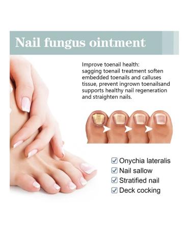 Ximonth antifungal set for nail care - Buy Online on GoSupps.com