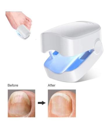 Nail fungus laser therapy device