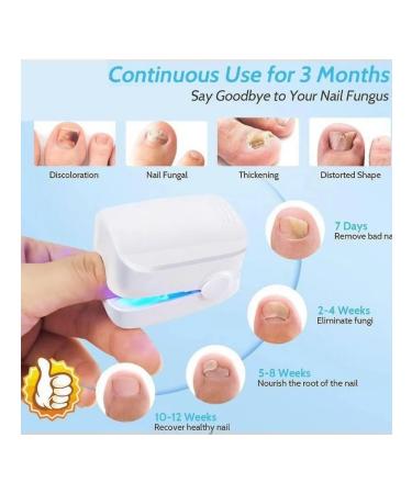Nail fungus laser therapy device - Buy Online on GoSupps.com