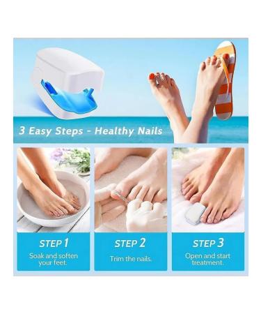 Nail fungus laser therapy device - Buy Online on GoSupps.com