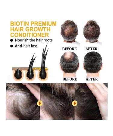 Biotin hair care recovery - Buy Online on GoSupps.com