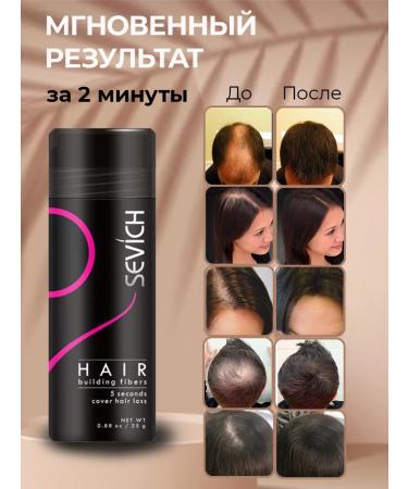 Sevich Hair thickened powder light brown - Buy Online on GoSupps.com