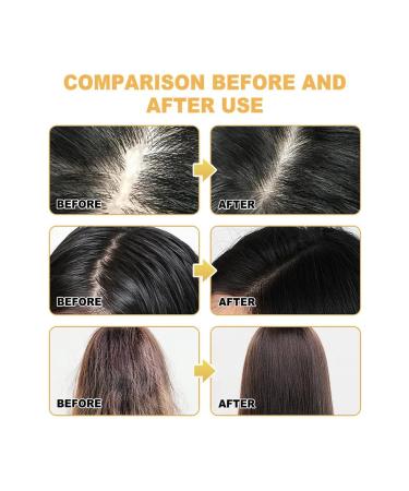Shampoo for hair growth with rosemary 100g ts 2pcs - Buy Online on GoSupps.com