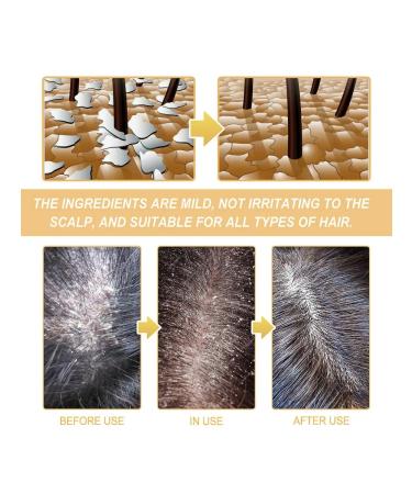 Shampoo for hair growth with rosemary 100g ts 2pcs - Buy Online on GoSupps.com