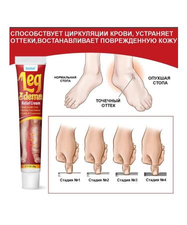 cosmetics sale Cream ointment from edema in the legs - Buy Online on GoSupps.com