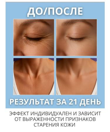 LEVUS Serum anti -aging with retinol niacinamide collagen - Buy Online on GoSupps.com