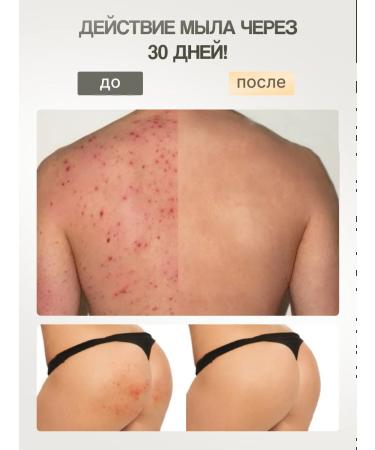 Waski Acne soap and Acne on the body with gray - Buy Online on GoSupps.com