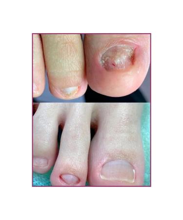 LIVSI Hel-serum for nails skin Parafin cream with monard - Buy Online on GoSupps.com