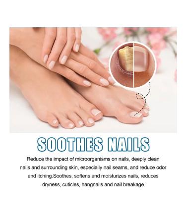 Fulgicide nail solution strengthens the nails - Buy Online on GoSupps.com