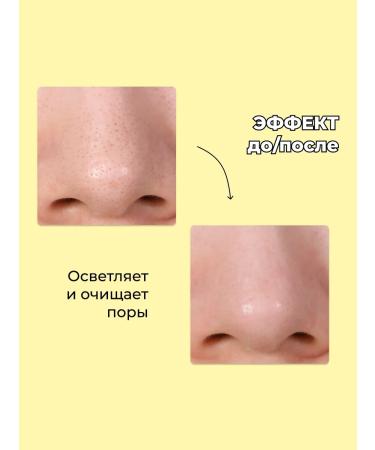 Tiam Serum for narrowing pores with 20% niacinamide - Buy Online on GoSupps.com