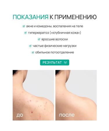 beauty365 Shower gel from acne with acids AHA+bha 250 ml - Buy Online on GoSupps.com