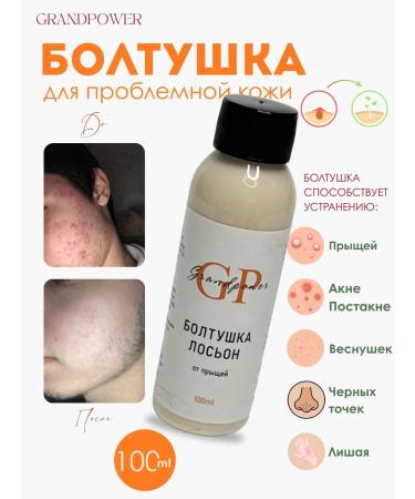 GRANDPOWER A chattering can of acne