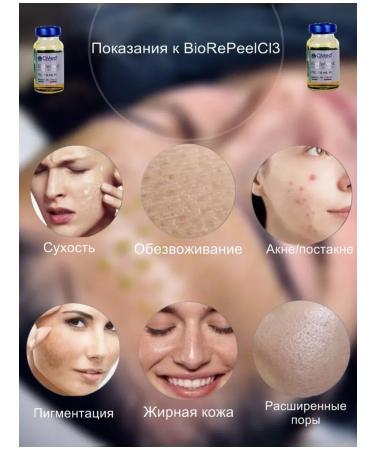 Professional face peeling Biorepan 6 ml - Buy Online on GoSupps.com
