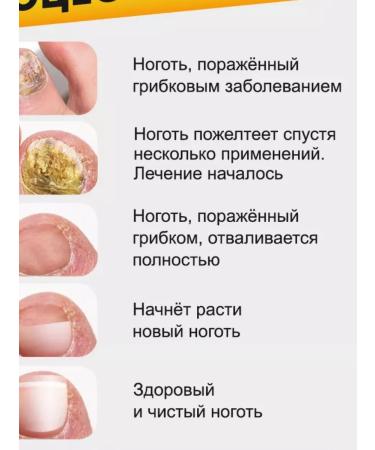 creams remedy for toenail fungus - Buy Online on GoSupps.com