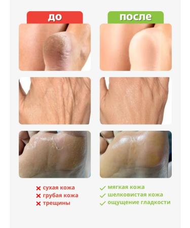 Crimean healer Cream from cracks on heels - Buy Online on GoSupps.com