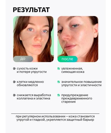 Holy Dew West serum Botox from wrinkles - Buy Online on GoSupps.com