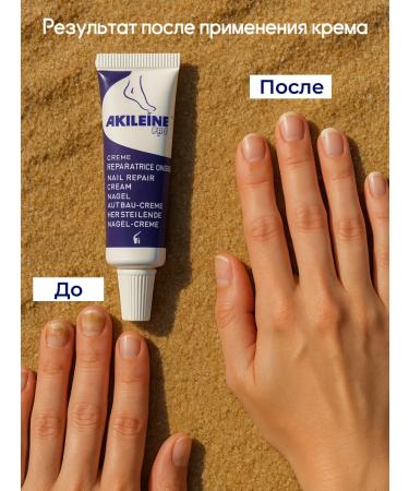 Akileine Cream for nail growth Restoring - Buy Online on GoSupps.com