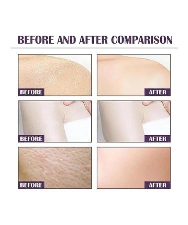 Body scrub with raspberry extract - Buy Online on GoSupps.com