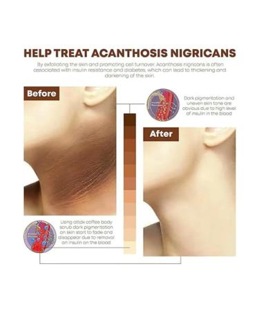 Body scrub with raspberry extract - Buy Online on GoSupps.com