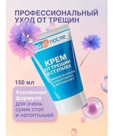 Before and After Moisturizing leg cream from cracks and dryness