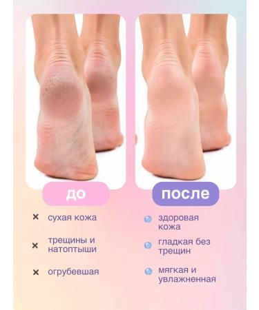 Before and After Moisturizing leg cream from cracks and dryness - Buy Online on GoSupps.com