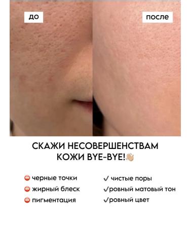 Chupsi Enzyme powder from black dots - Buy Online on GoSupps.com