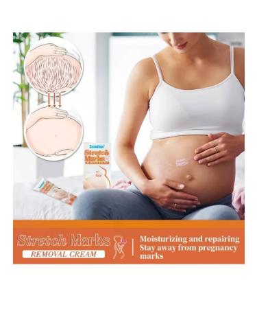 Janar brands Cream from stretch marks for pregnant women from scars and scars - Buy Online on GoSupps.com