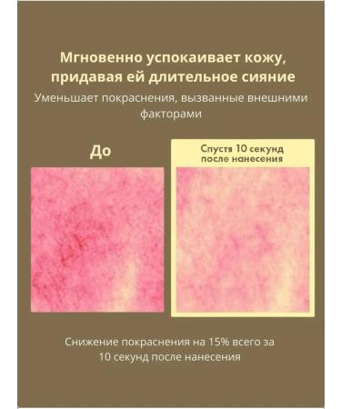 AXIS Y Toner -MIST Lighting Axis Way - Buy Online on GoSupps.com