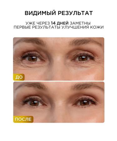 Lena Levi Eye and skin cream around the eyes with mucin - Buy Online on GoSupps.com