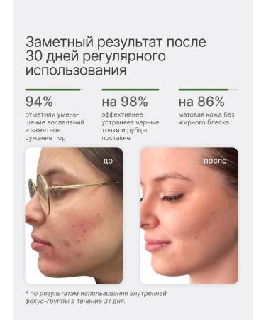 Permegi Seborrheal serum seborrheal with niacinamide 30 ml - Buy Online on GoSupps.com