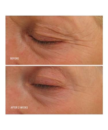 HydroPeptide Moisturizer Eye Authority 15 ml - Buy Online on GoSupps.com