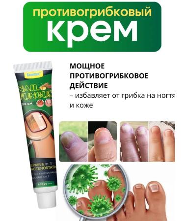 NazzSmile Chinese remedy for nail fungus treatment