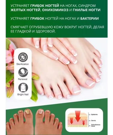 NazzSmile Chinese remedy for nail fungus treatment - Buy Online on GoSupps.com