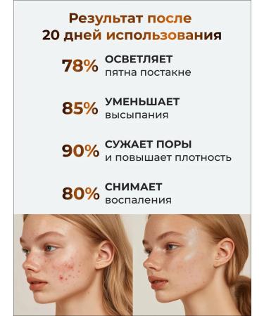 Mesonica Face cream with retinol - Buy Online on GoSupps.com