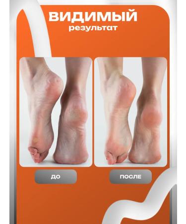 A treasure trove Whitening foot mask niacinamide and vitamin C socks - Buy Online on GoSupps.com