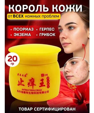 All discounts are here King of the skin cream from psoriasis ointment from acne dermatitis eczema