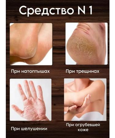 SKIN 1004 Cream-Vosk in the stick restores for the legs and body-2 pcs - Buy Online on GoSupps.com