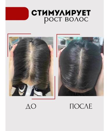 AmiAmi Hair shampoo from falling out and for growth - Buy Online on GoSupps.com