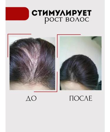 AmiAmi Hair shampoo from falling out and for growth - Buy Online on GoSupps.com