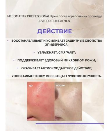 Mesomatrix Professional Face cream after aggressive procedures 150ml - Buy Online on GoSupps.com