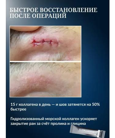 Pisces collagen without additives - Buy Online on GoSupps.com