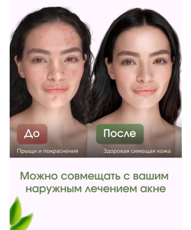 LAB Popular acne cream for problem skin - Buy Online on GoSupps.com