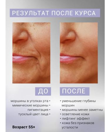 PixelTap Beauty Carboxytherapy for the face Gift set - Buy Online on GoSupps.com